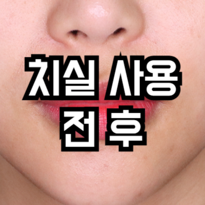 치실 사용 전 후